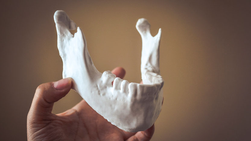 Development of a 3D printing system for obtaining personalized dental prostheses